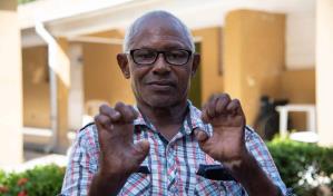 La lepra, un mal lejos de ser erradicado