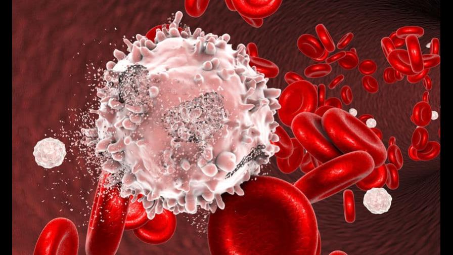 México registra 18,000 casos anuales de cánceres hematológicos México registra 18,000 casos anuales de cánceres hematológicos