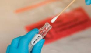 Salud reporta un contagio de covid-19 en las últimas 24 horas