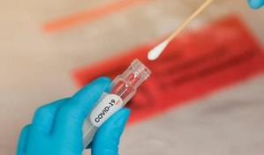 Autoridades reportan 111 casos activos de COVID-19