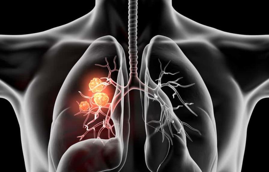 Una molécula para tratamiento contra el cáncer de pulmón llega México