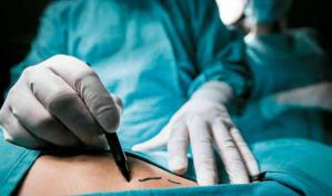 Investigan red de m&eacute;dicos que usaban implantes card&iacute;acos sacados de cad&aacute;veres