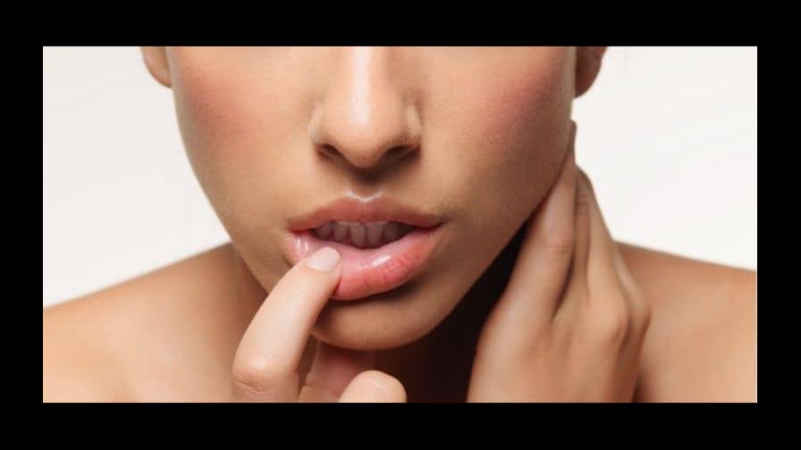 Por qué pueden aparecer boqueras Por qué pueden aparecer boqueras