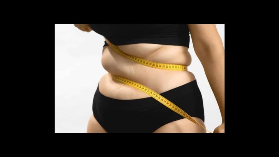 La obesidad, una condición más allá del aspecto físico