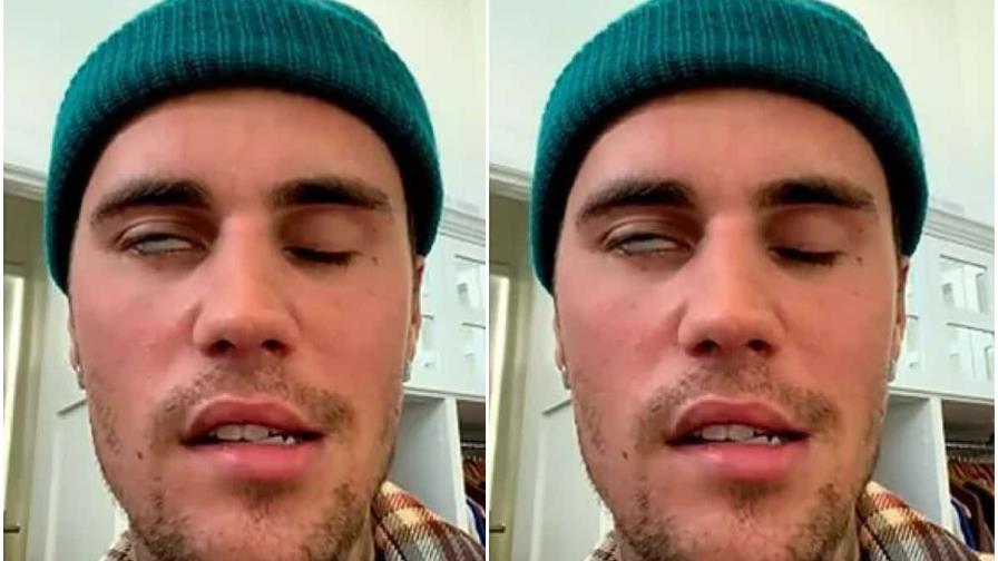 Justin Bieber recupera la sonrisa tras meses de enfermedad Justin Bieber recupera la sonrisa tras meses de enfermedad