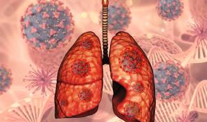 Un plan reduce a más de la mitad los casos de tuberculosis en el Brasil más pobre Un plan reduce a más de la mitad los casos de tuberculosis en el Brasil más pobre