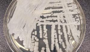 Aumentan los casos de una superbacteria en EEUU durante pandemia