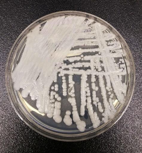 Aumentan los casos de una superbacteria en EEUU durante pandemia