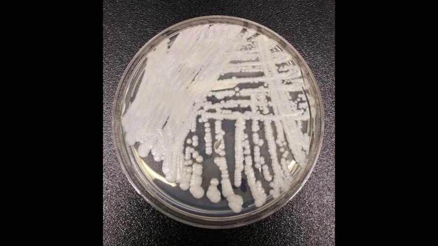 Aumentan los casos de una superbacteria en EEUU durante pandemia Aumentan los casos de una superbacteria en EEUU durante pandemia