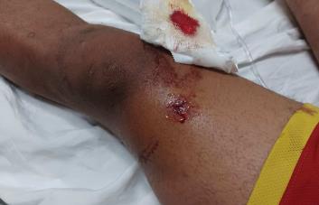 Adolescente resulta herido de bala durante persecución policial a supuesto delincuente en Santiago