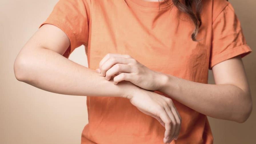 Qué es la alergia emocional