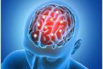 La FDA aprueba un nuevo medicamento contra el Alzheimer La FDA aprueba un nuevo medicamento contra el Alzheimer
