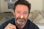 Hugh Jackman se somete a dos nuevas biopsias ante el riesgo de cáncer de piel Hugh Jackman se somete a dos nuevas biopsias ante el riesgo de cáncer de piel