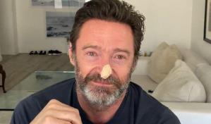 Hugh Jackman se somete a dos nuevas biopsias ante el riesgo de cáncer de piel
