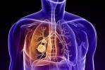 Establecen cómo la contaminación atmosférica puede provocar cáncer de pulmón Establecen cómo la contaminación atmosférica puede provocar cáncer de pulmón