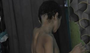 La triste vida de Maicol, un joven ciego y sin habla que vive en la miseria