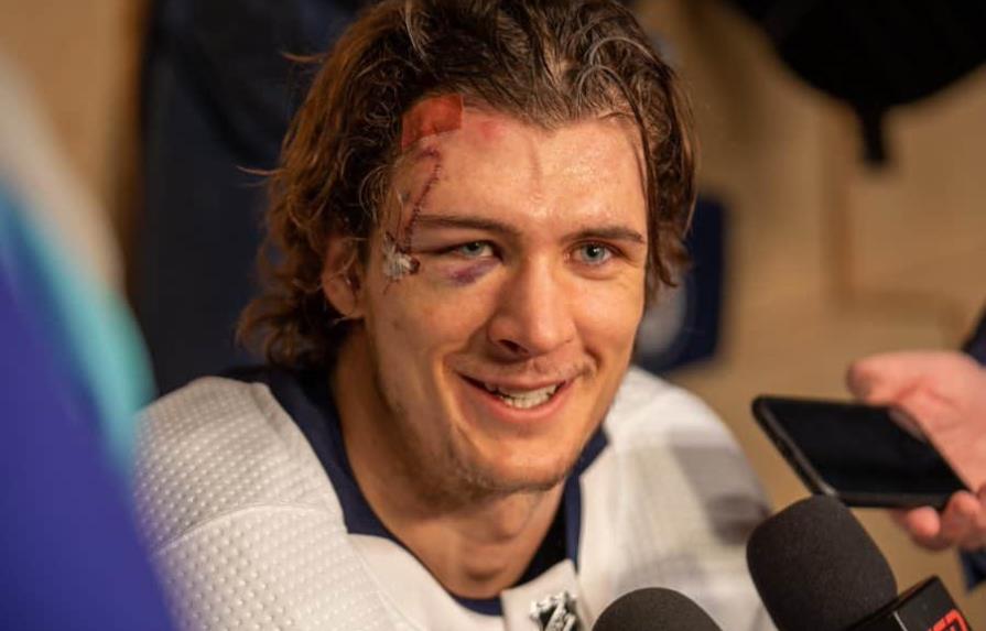 Recibió cortadura que requirió 75 puntos en la cara y volvió a partido de hockey