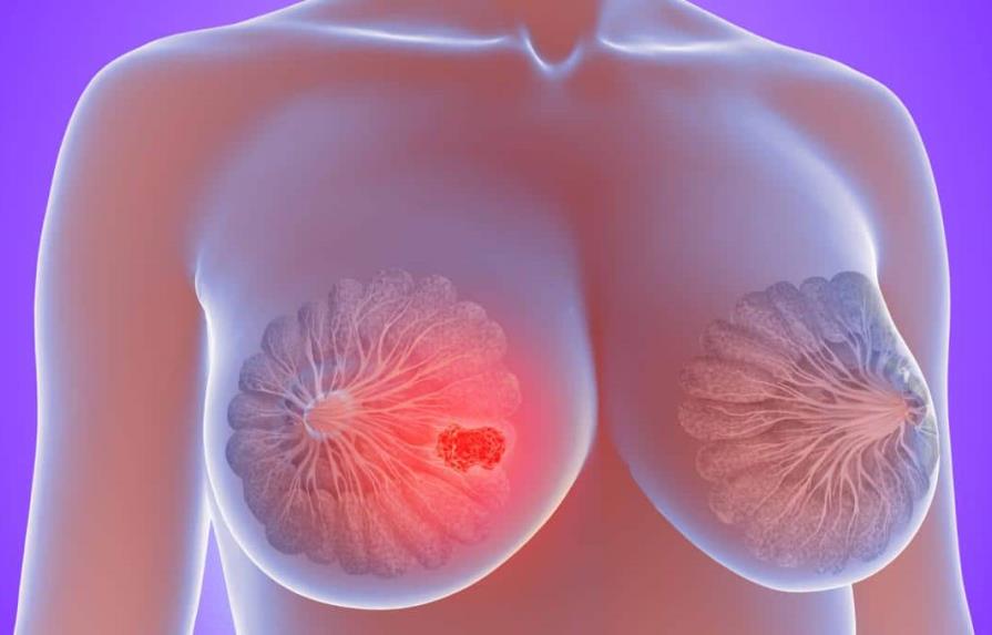 Células pueden reprogramarse para combatir el cáncer de mama, según estudio