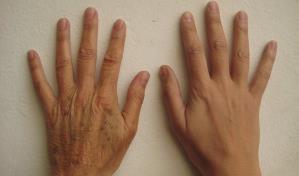 Un estudio logra ralentizar el envejecimiento de las c&eacute;lulas en levadura