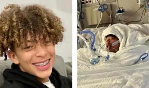 Desafío de TikTok deja a un adolescente desfigurado con casi el 80 % del cuerpo quemado