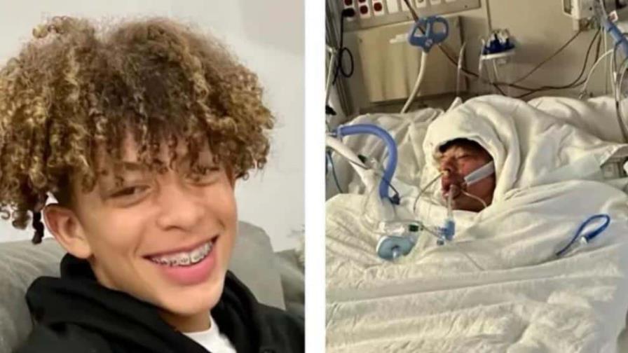 Desafío de TikTok deja a un adolescente desfigurado con casi el 80 % del cuerpo quemado