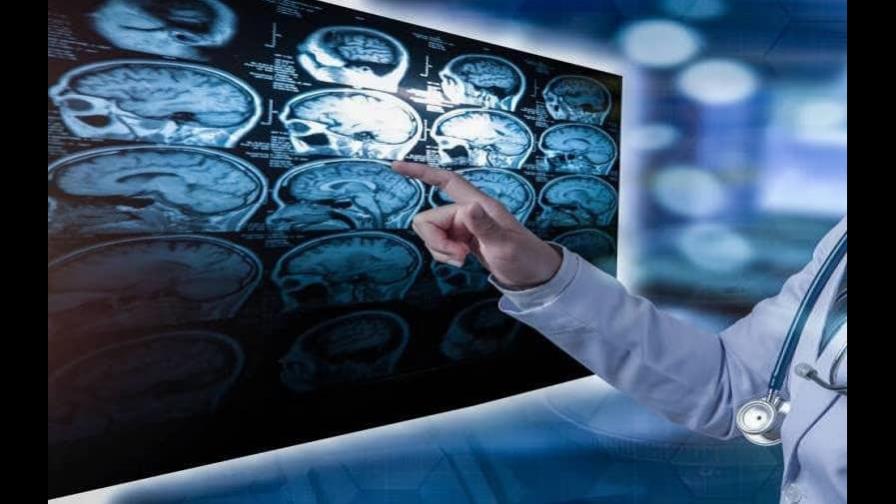 El cerebro puede continuar en actividad después de la muerte cardíaca, según estudio El cerebro puede continuar en actividad después de la muerte cardíaca, según estudio