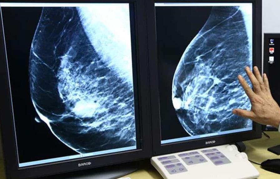 Grupo de Estados Unidos recomienda mamografías a partir de los 40 años