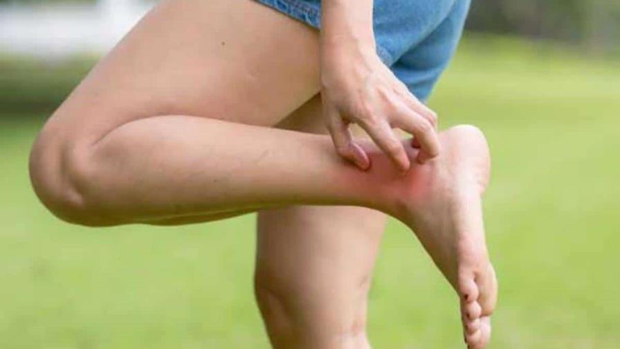 El jabón que usas puede hacerte más atractivo para los mosquitos