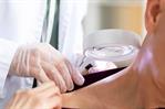 En el país se diagnostican entre siete y ocho pacientes con cáncer de piel cada día