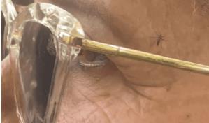 Enjambre de mosquitos ataca a personas en Santiago e impide hasta dar clases