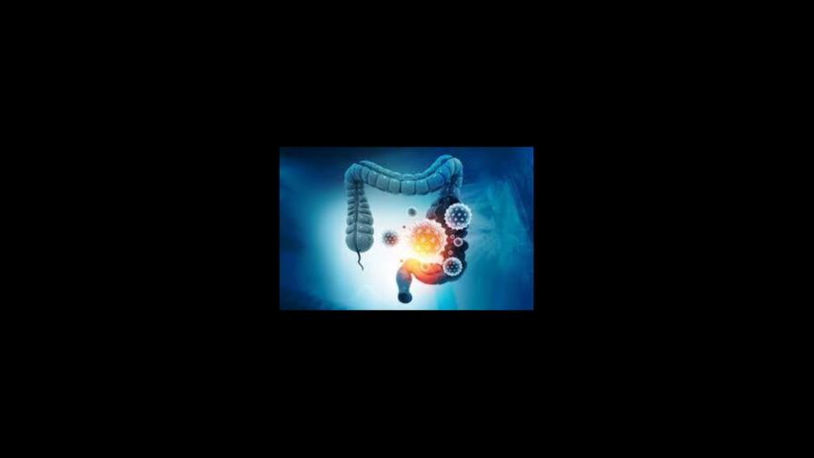 Terapia sin radiación ofrece esperanza en la batalla contra el cáncer de recto