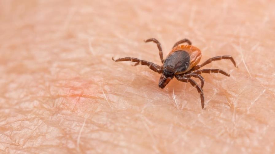 Justin Bieber y la enfermedad de Lyme Justin Bieber y la enfermedad de Lyme