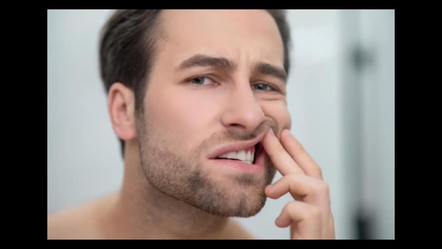 Lo que debes saber sobre la gingivitis, la enfermedad que padece Alex Rodríguez