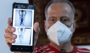 Brasil avanza en el estudio del CAR-T y logra la remisi&oacute;n plena del c&aacute;ncer en un paciente