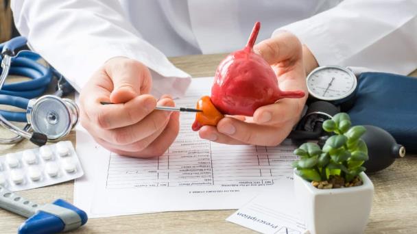 Cáncer de próstata: ¿si hay síntomas es porque está en una etapa avanzada?