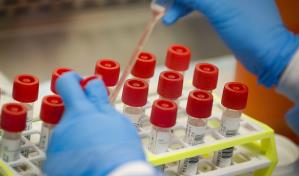 Cae la confianza en la ciencia y la medicina entre los adultos estadounidenses  