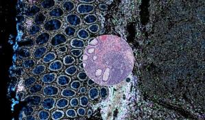 Orion, la nueva herramienta para diagnosticar el cáncer