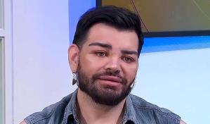 Hombre se operó más de 30 veces para parecerse a Ricky Martin y los resultados fueron desastrosos