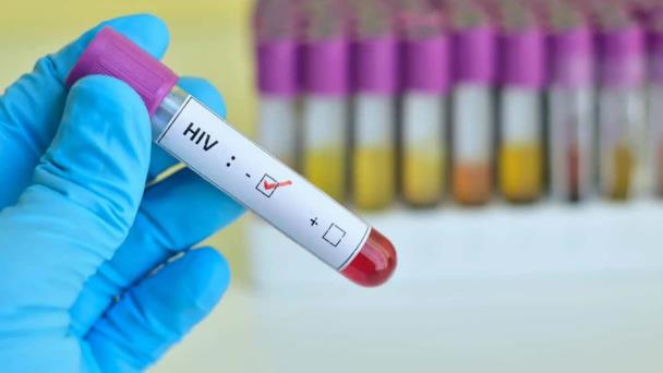 En Puerto Rico es diagnosticada una persona diariamente con el VIH