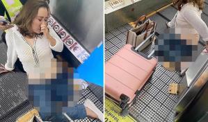 Mujer que perdió su pierna al quedar atrapada en escalera eléctrica recibe atención psiquiátrica