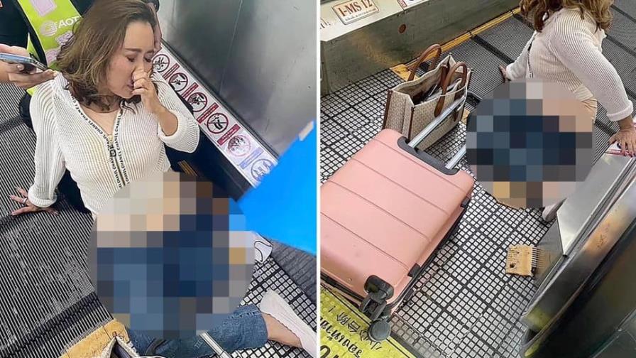 Mujer que perdió su pierna al quedar atrapada en escalera eléctrica recibe atención psiquiátrica