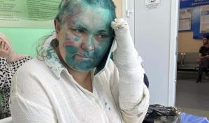 EE.UU. exige a Rusia investigar el brutal ataque a la periodista Yelena Miláshina en Chechenia EE.UU. exige a Rusia investigar el brutal ataque a la periodista Yelena Miláshina en Chechenia