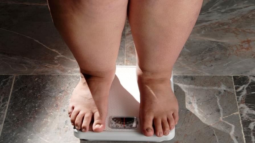 Un nuevo estudio vincula el sobrepeso y la obesidad con 18 tipos de cáncer