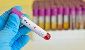 Un nuevo caso de remisión del VIH tras un trasplante de médula ósea