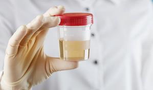 Una muestra de orina puede servir para diagnosticar el cáncer de endometrio