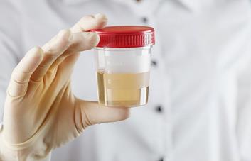 Una muestra de orina puede servir para diagnosticar el cáncer de endometrio