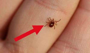 Alergólogos difieren sobre pacientes en RD con alergia a la carne roja causada por garrapata