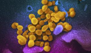 EEUU iniciará estudios sobre tratamientos para secuelas de COVID