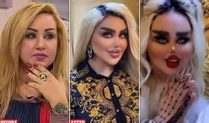 La presentadora y actriz que se ha sometido a más de 40 cirugías para parecerse a Barbie