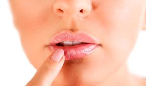 Herpes labial: estas son las tres causas principales Herpes labial: estas son las tres causas principales